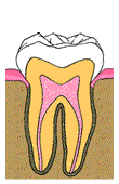 diagram of abscessed tooth